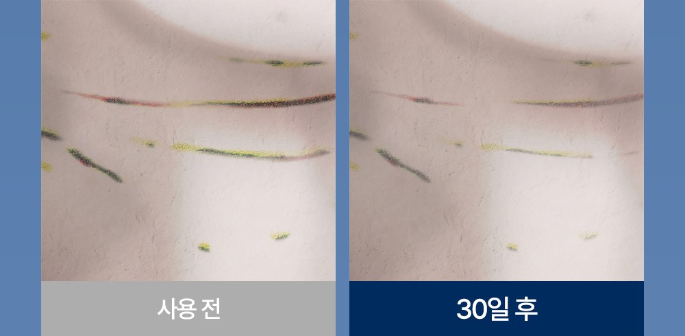 [잠웰] 주르밍 목주름 베개 화이트 상세 이미지 4