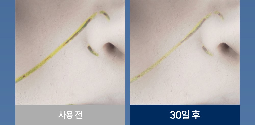[잠웰] 주르밍 목주름 베개 화이트 상세 이미지 3